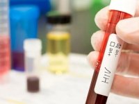Güney Afrika ve Brezilya'da HIV enfeksiyonu uzun süre etkili aşılarla önlenecek