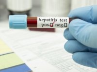DSÖ: Gizemli hepatit vakaları 650'ye, can kayıpları 9'a yükseldi