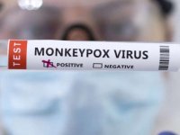 Meksika'da 5 kişide daha maymun çiçeği virüsü tespit edildi