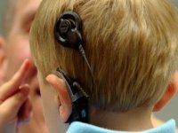 İşitme kaybı bulunan çocukların sessiz dünyaları biyonik kulakla değişti