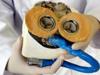 İleri derecede kalp yetmezliği olan hasta yapay kalple hayata döndü