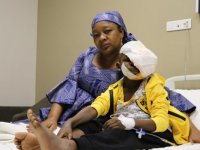 Tümörün yüzünü kapladığı Kamerunlu çocuk Gaziantep'te ameliyat edildi