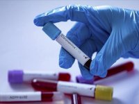 Araştırma: Tekrarlanan Kovid-19 enfeksiyonları "organ yetmezliği ve ölümlere" yol açabilir