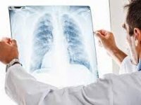 Akciğer kanseri en çok erkeklerde görülüyor