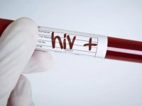 Resmi kayıtlara göre Türkiye'de 32 bin 376 kişi HIV ile yaşıyor