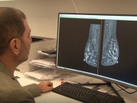Mamografi İşlemi İle İlgili Efsaneler Yeni Cihazlarla Son Buldu