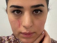 Mersin'de kadın doktoru darbettikleri iddiasıyla 2 şüpheli gözaltına alındı