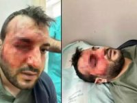Balıkesir'de doktorlar arasında çıkan kavgaya ilişkin soruşturma başlatıldı