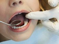 Engelli hastaların diş tedavilerini SGK karşılıyor