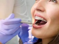 Ortodontik Sorunlar Öz Güven Problemlerine Yol Açabiliyor
