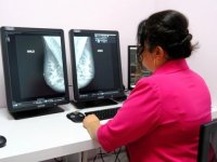 Sivas Cumhuriyet Üniversitesinde mamografi cihazı hizmete girdi
