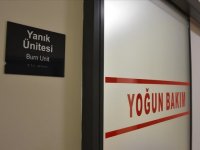 Eskişehir Şehir Hastanesi Yanık Merkezi yıllık yaklaşık 4 bin poliklinik hizmeti veriyor