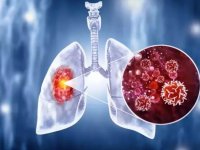 Kemer İlçe Sağlık Müdürlüğünden "Akciğer Kanseri Farkındalık Ayı" açıklaması