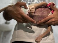 İsrail'in açlık ve kıtlığı dayattığı Gazze Şeridi'nde açlıktan ölenlerin sayısı 127'ye yükseldi