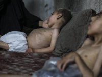 İsrail saldırısında yaralanan Gazzeli 2 kardeş, yetersiz beslenme nedeniyle iyileşemiyor