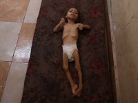 İsrail saldırıları ve ablukası altındaki Gazze'de "Guillain-Barre sendromlu" 95 yeni vaka tespit edildi