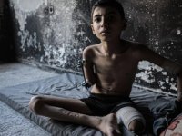 İsrail'in saldırısında kol ve bacağını kaybeden Semir, eskisi gibi futbol oynamak istiyor