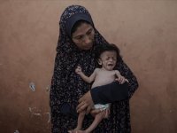 Gazze'de yetersiz beslenme sorunu yaşayan 5 aylık bebeğin annesi çocuğunun ölmesinden korkuyor
