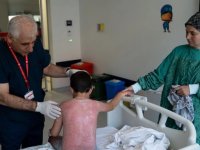 Güneşte 4 saat kalan çocuk, ikinci derece yanıkla hastanelik oldu
