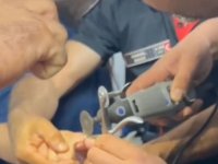 Kahramanmaraş'ta genç kızın parmağında sıkışan yüzük itfaiye ekibince hastanede çıkarıldı