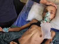 Gazze'de yardım almaya giderken başından vurularak felç kalan 16 yaşındaki Muhenned adeta "iskelete" dönüştü