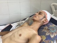 Gazze'de yardım almaya giderken başından vurulan Filistin halk oyunları dansçısı Ahmed'in hayatı karardı