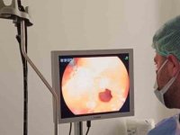 Çermik Devlet Hastanesinde endoskopi ve kolonoskopi ünitesi hizmete girdi