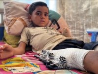 İsrail'in, Gazze'de oyun oynarken hedef aldığı küçük Esed, tedavi olup yeniden "çocuk olmak" istiyor