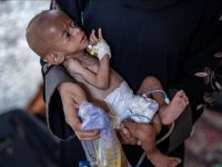 Yetersiz beslenme kaynaklı can kayıplarının arttığı Gazze'de hastanelerdeki çocuklar adeta ölümü bekliyor