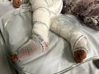 Sınır Tanımayan Doktorlar'dan İsviçre'nin tedavi için Gazzeli hastaları kabul etme kararına destek