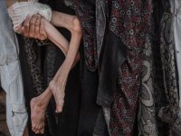 İsrail'in ablukası nedeniyle kıtlık yaşanan Gazze’de açlıktan ölenlerin sayısı 457’ye yükseldi
