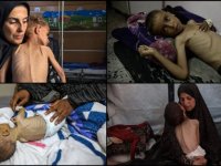 Gazze'de İsrail'in açlıktan ölüme mahkum ettiği çocukların hikayeleri soykırımın boyutunu gösteriyor
