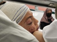 Filistinli doktor Karmi, Türkiye'nin İsrail'i durdurmak için çözüm bulabileceğine inandığını söyledi: