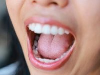 Dil rengi ve dokusu sağlık sorunlarının habercisi olabilir