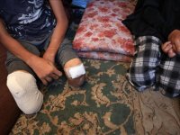 Filistin Sağlık Bakanlığı: Gazze nüfusa oranla dünyada en fazla ampute çocuk sayısına sahip