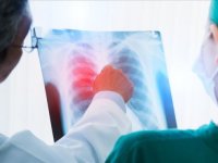 Akciğer kanserinde çevresel faktörlerin etkisi artıyor