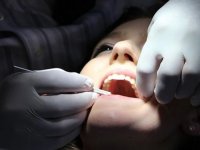 Sağlık Bakanlığından dental travmalara karşı acil müdahale rehberi