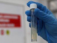 DSÖ: Tüberküloz nedeniyle her yıl bir milyon kişi hayatını kaybediyor