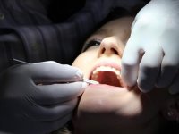 İlerleyen diş çürüğü sistemik hastalıkları tetikleyebilir