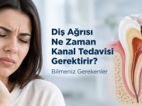 Diş Ağrısı Ne Zaman Kanal Tedavisi Gerektirir? Bilmeniz Gerekenler