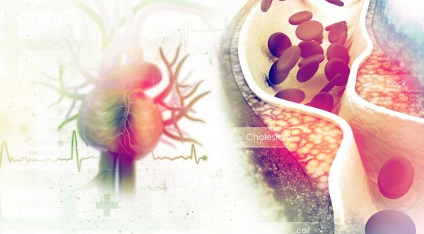 damar-sertligi-kolesterol-kalp.jpg
