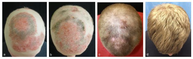 kellik-romatizma-ilaci2.jpg kellik-romatizma-ilaci2.jpg