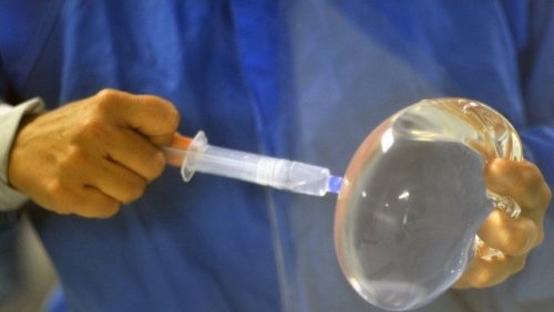 Meme protezinde kanser riski uyarısı