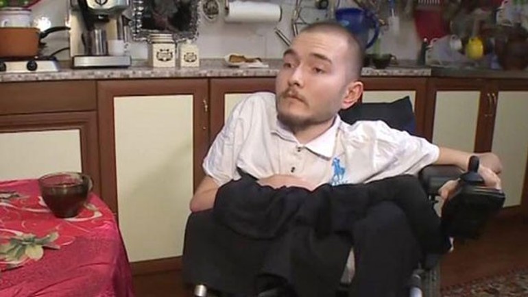 Kafa nakli 1 yıl sonra