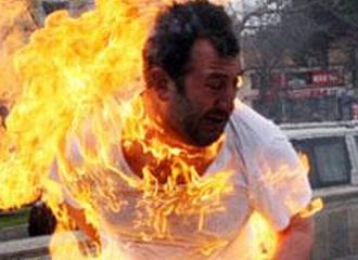 Vatandaş kendini böyle yaktı