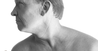 Gırtlak kanseri tedavi ve korunma yöntemleri