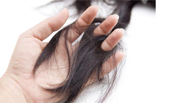 Yanlış Diyet Kel Bırakıyor