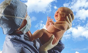 Dördüz Doğum Videosu-National Geographic Belgesel